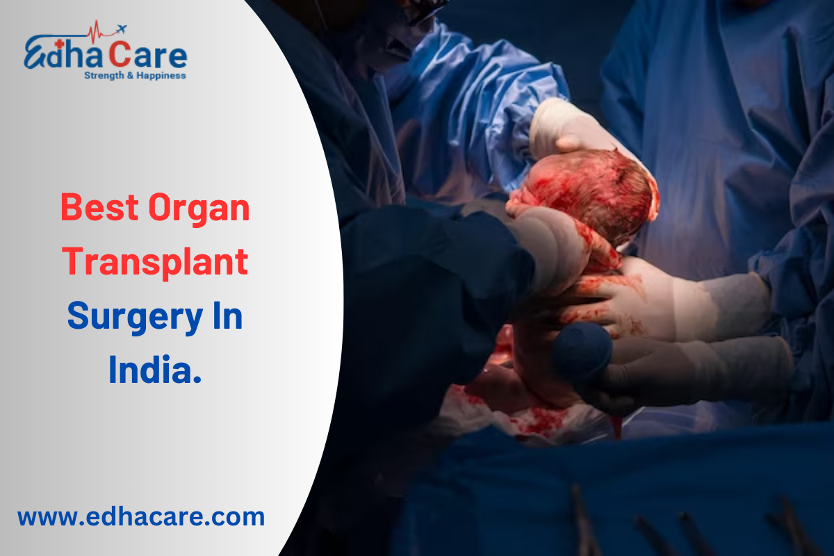 Best Organ Transplant Surgery In India