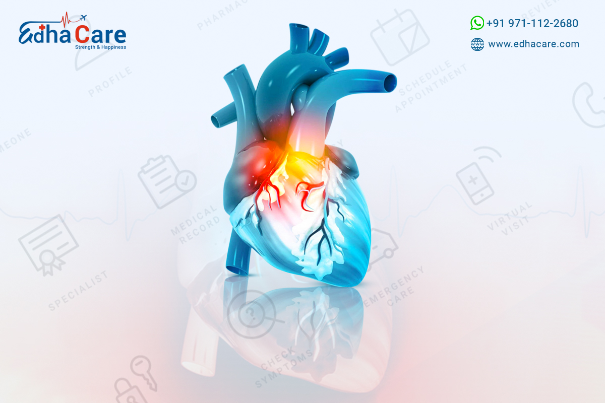 What Is Cardiology ? Find Best Cardiologist in India