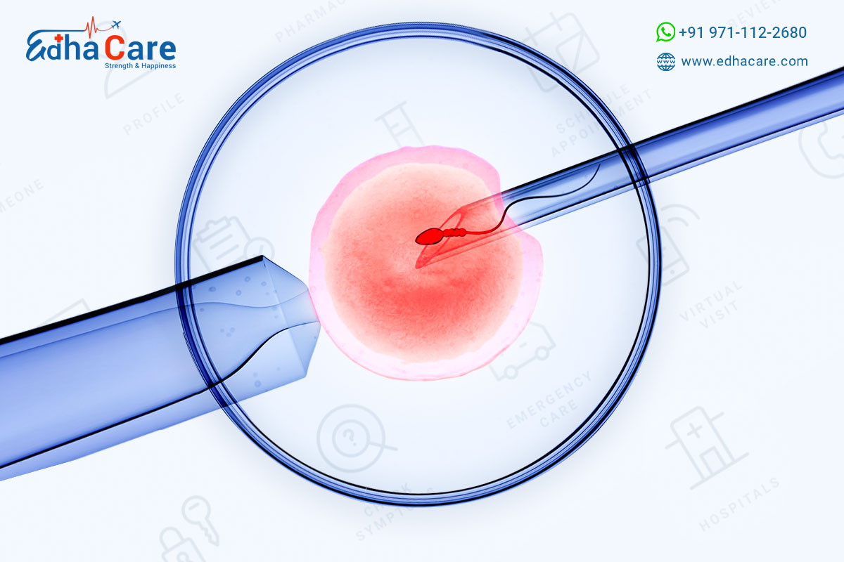 What is In-Vitro Fertilization (IVF)?