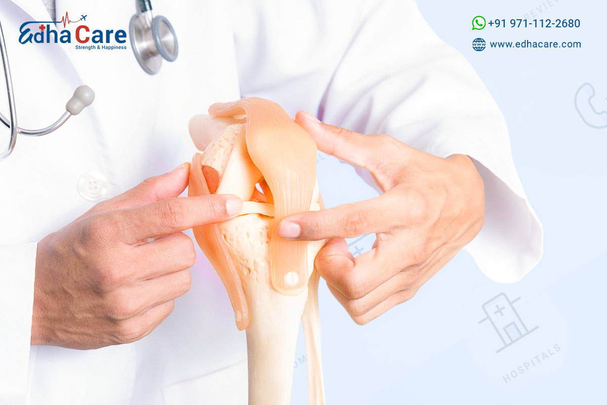 What is Orthopedic