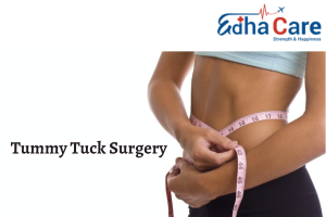 Tummy Tuck Surgery