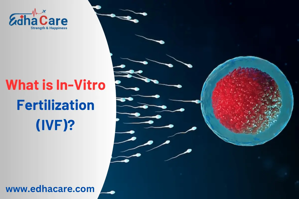 O que é fertilização in vitro (FIV)?