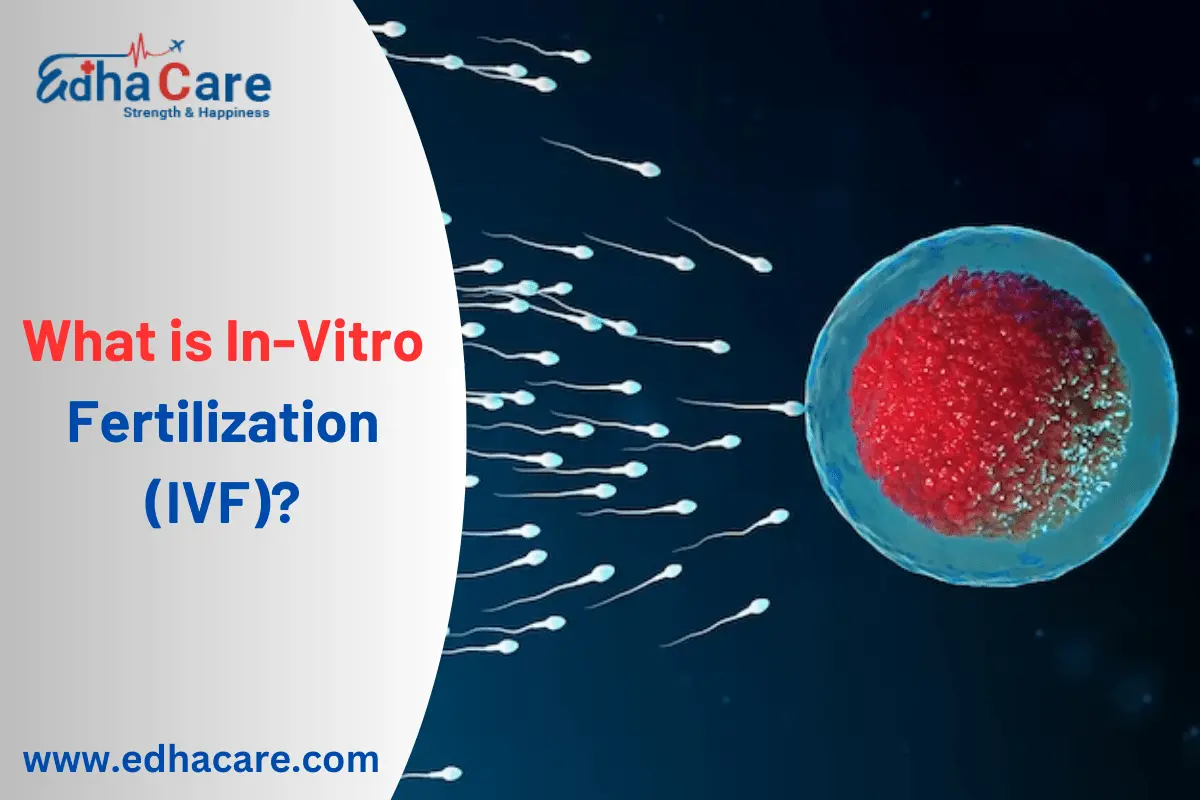 What is In-Vitro Fertilization (IVF)?