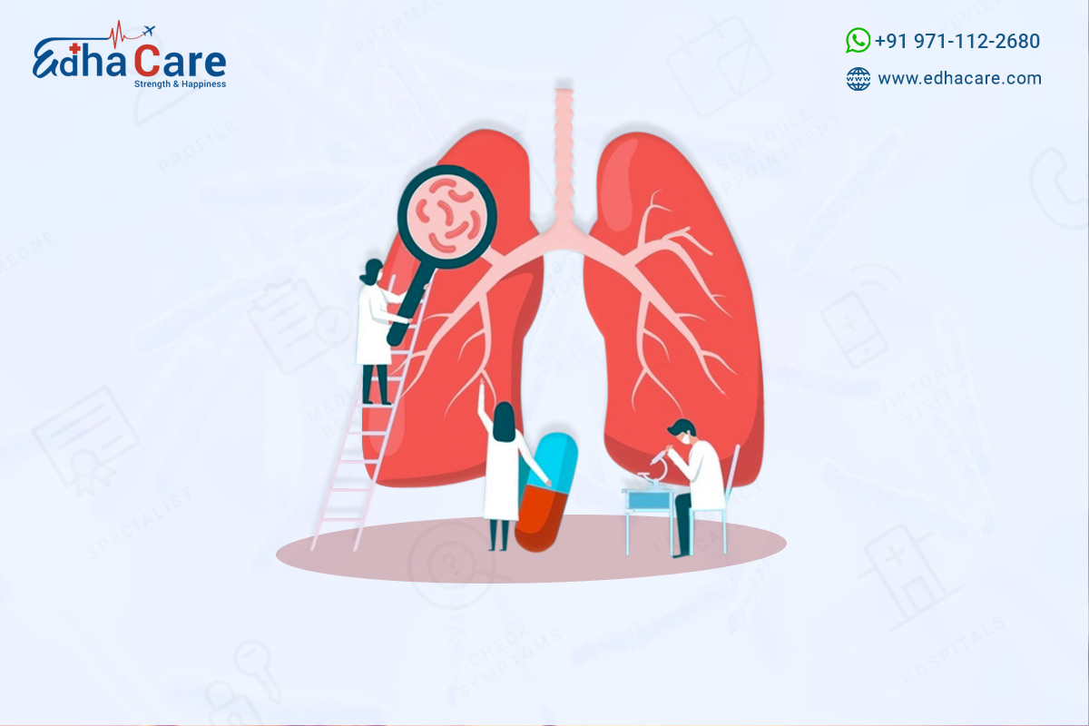 Lung Cancer Treatment In India
