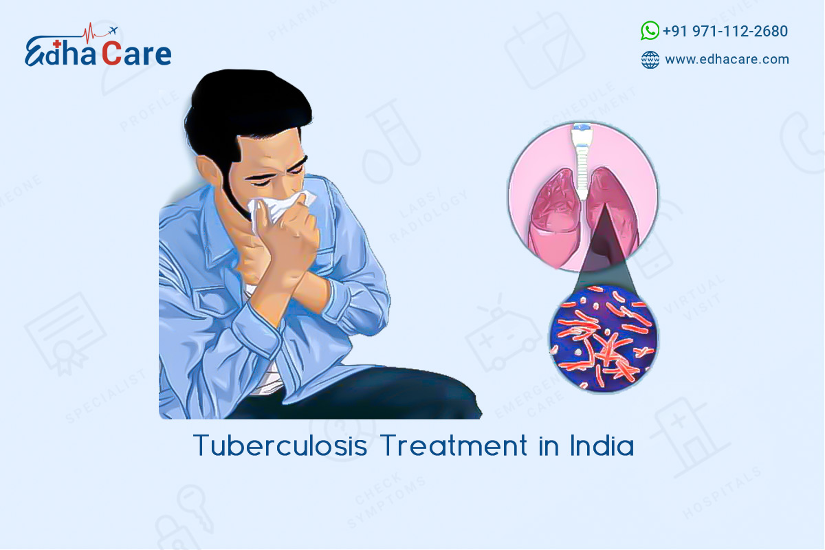 Tuberculosis Treatment in India