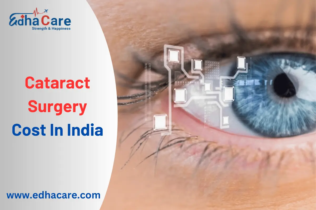Стоимость хирургии катаракты в Индии
