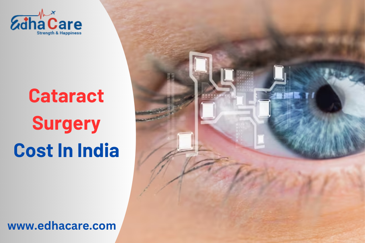 Cataract Surgery Cost In India