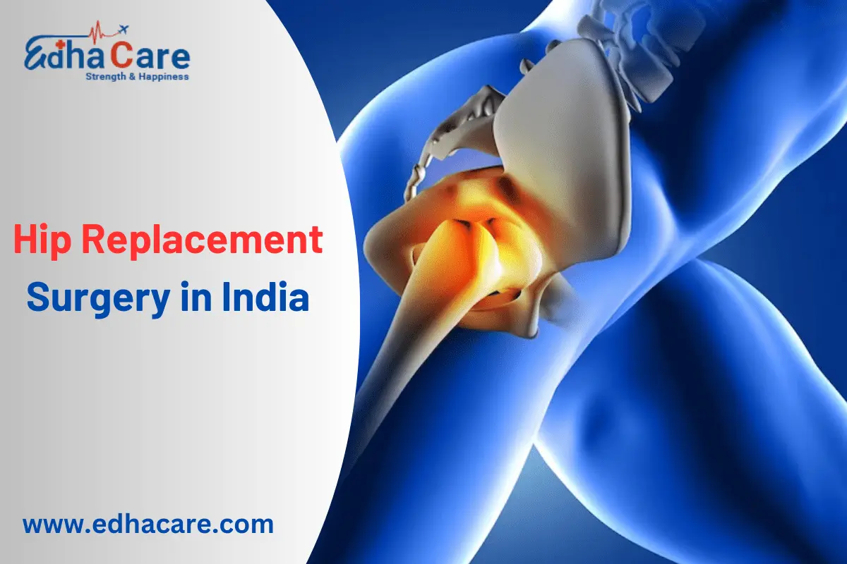 Chirurgie de remplacement de la hanche en Inde