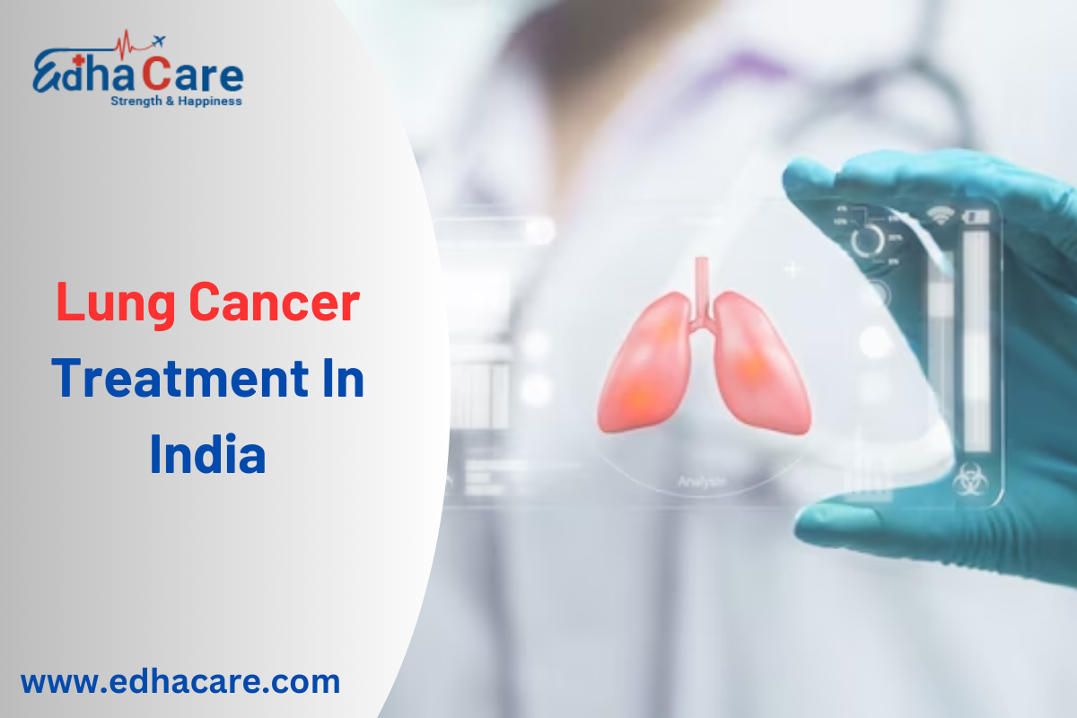 Lung Cancer Treatment In India