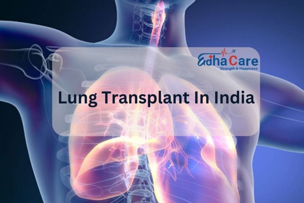 Lung Transplant in India – Best Hospitals & Care