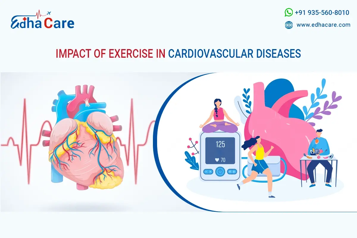 L'exercice réduit les maladies cardiovasculaires