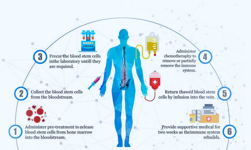 bone_marrow_transplant_procedure