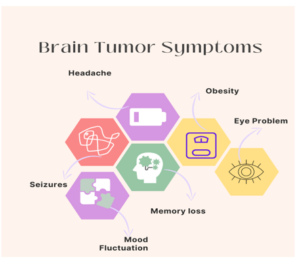 Síntomas de tumor cerebral.