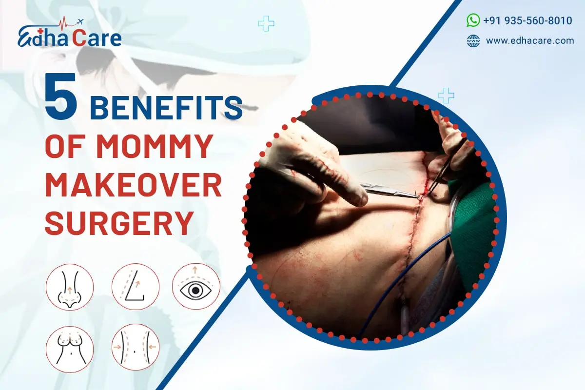 Mommy Makeover Surgery: 5 Major Benefits