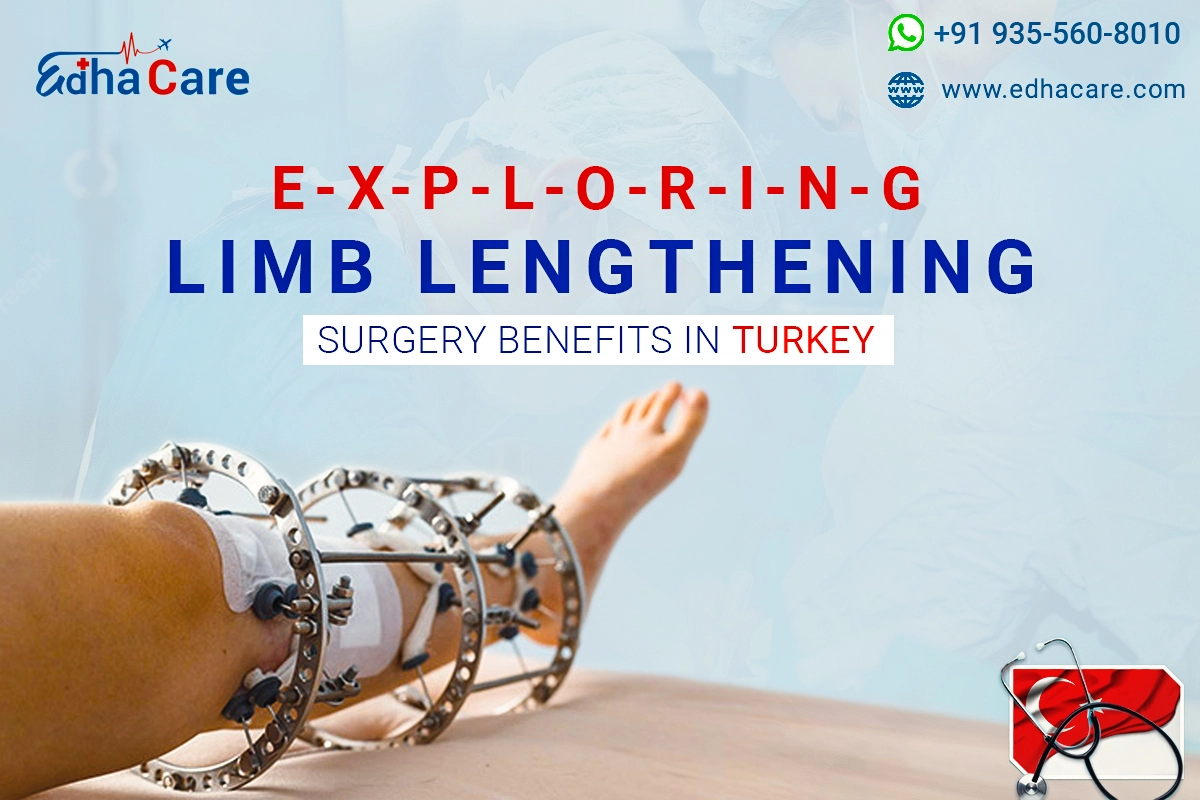 5 beneficios de la cirugía de alargamiento de extremidades en Turquía