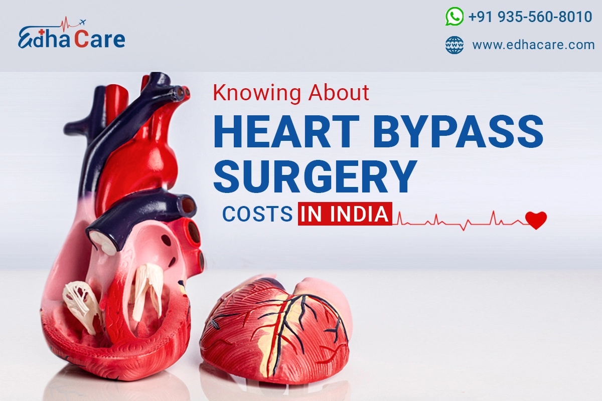 Knowing About Heart Bypass Surgery Cost in India
