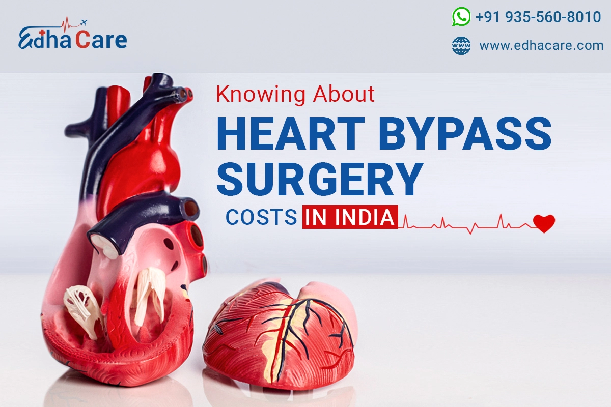 Costul operației de bypass cardiac în India