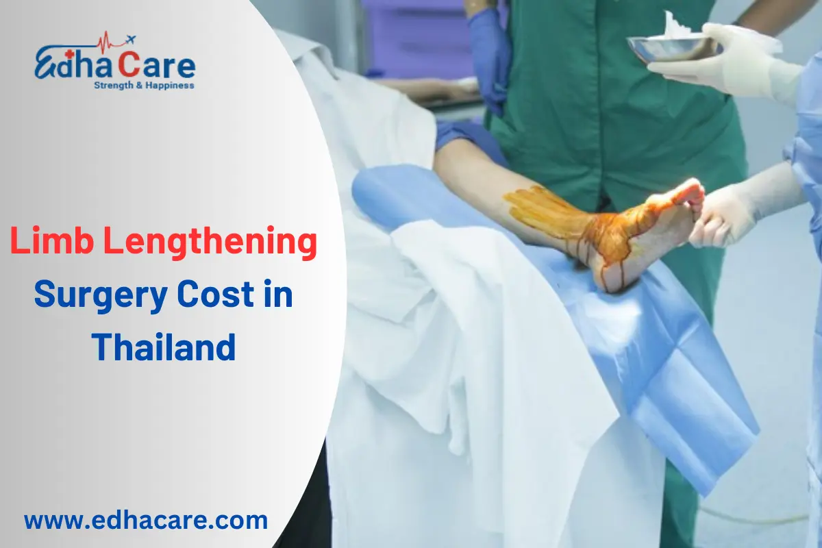 Le prix de la chirurgie d’allongement des membres en Thaïlande