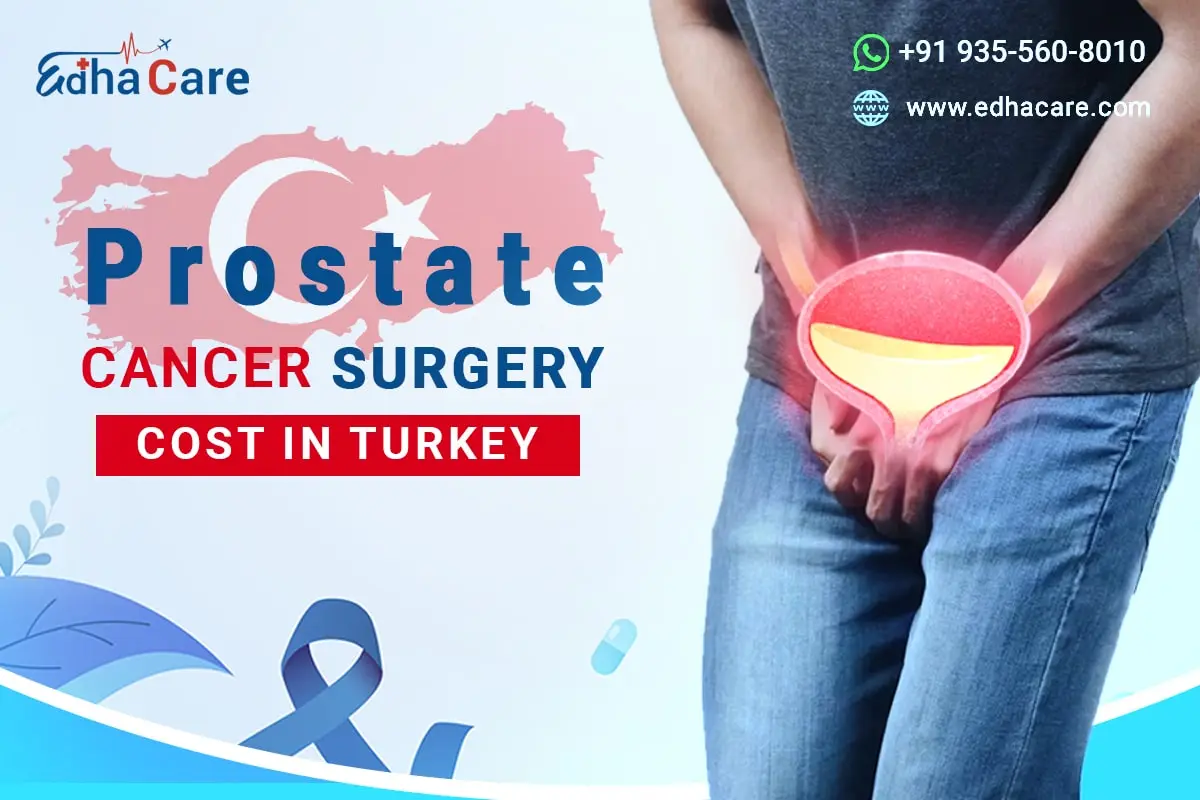 هزینه جراحی سرطان پروستات در ترکیه