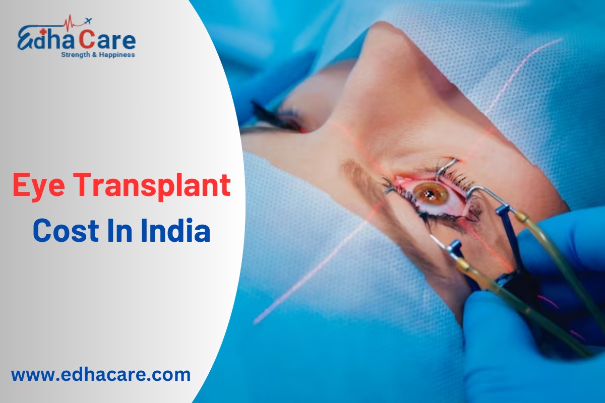 Costo del trasplante de ojos en la India: una guía completa para la restauración de la visión