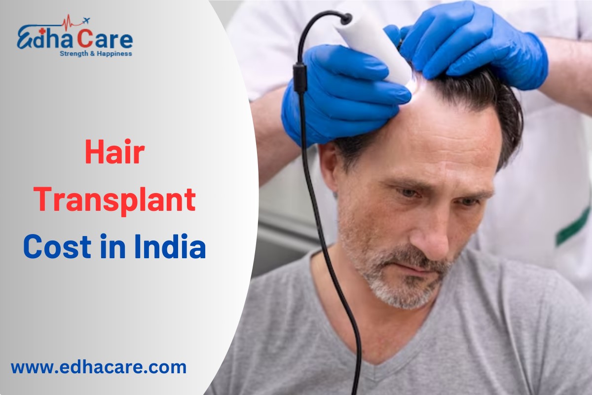 Costo del trasplante de cabello en la India