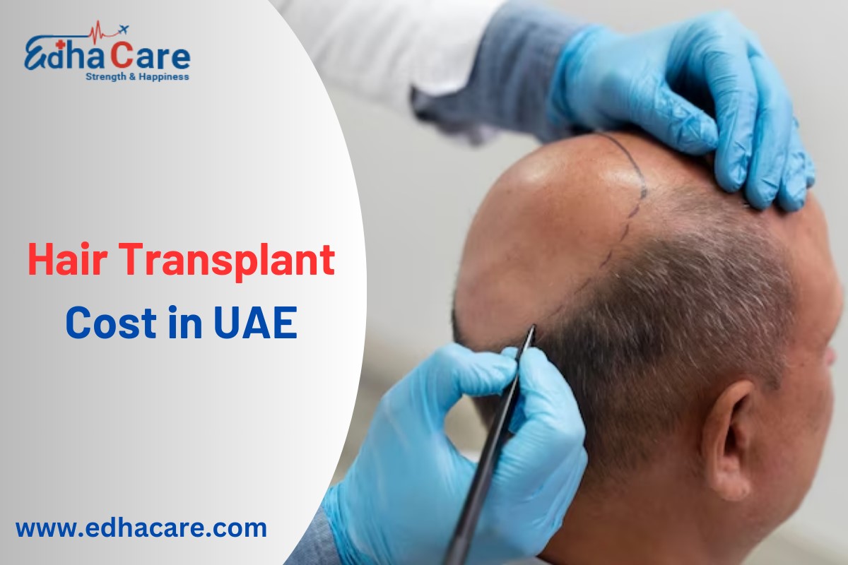 Hair transplant cost in UAE