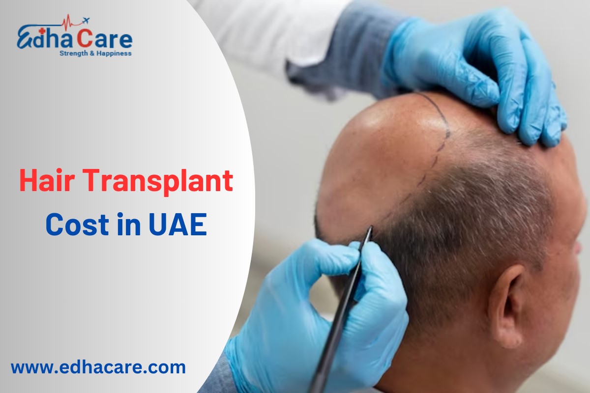 Hair Transplant Cost in UAE