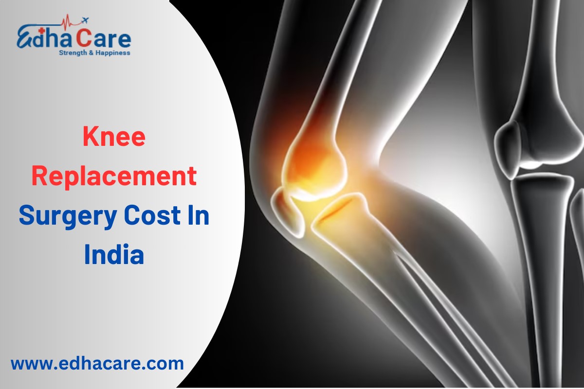 Custo de cirurgia de substituição do joelho na Índia