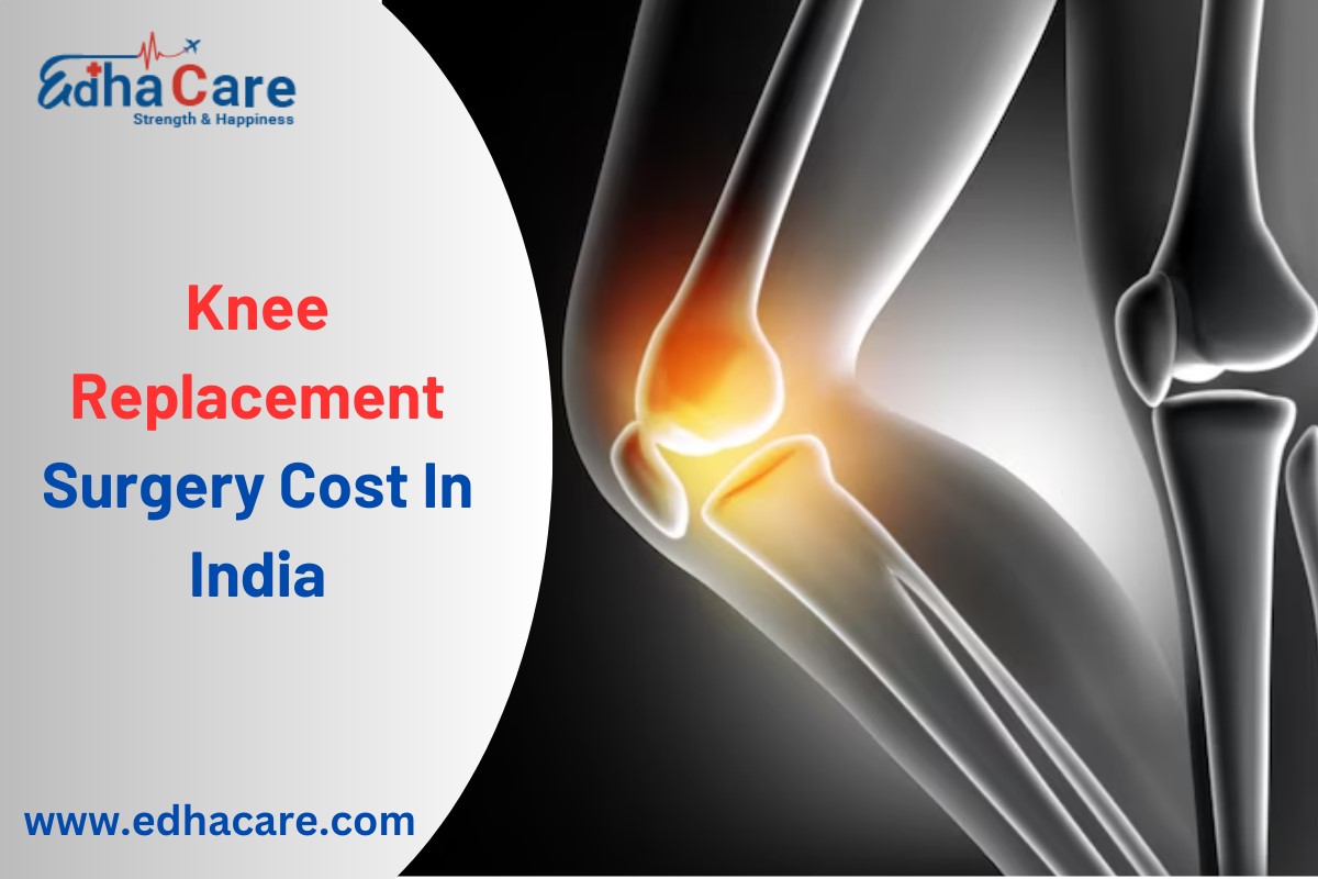 Knee replacement surgery cost in India