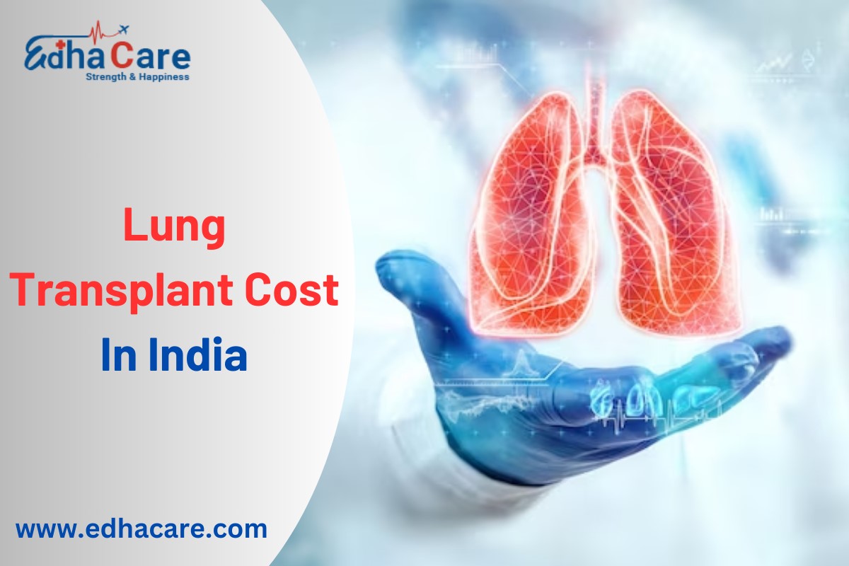 Costul transplantului pulmonar în India