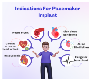 Hindistan'da kalp pili implantasyonu maliyeti için endikasyonlar