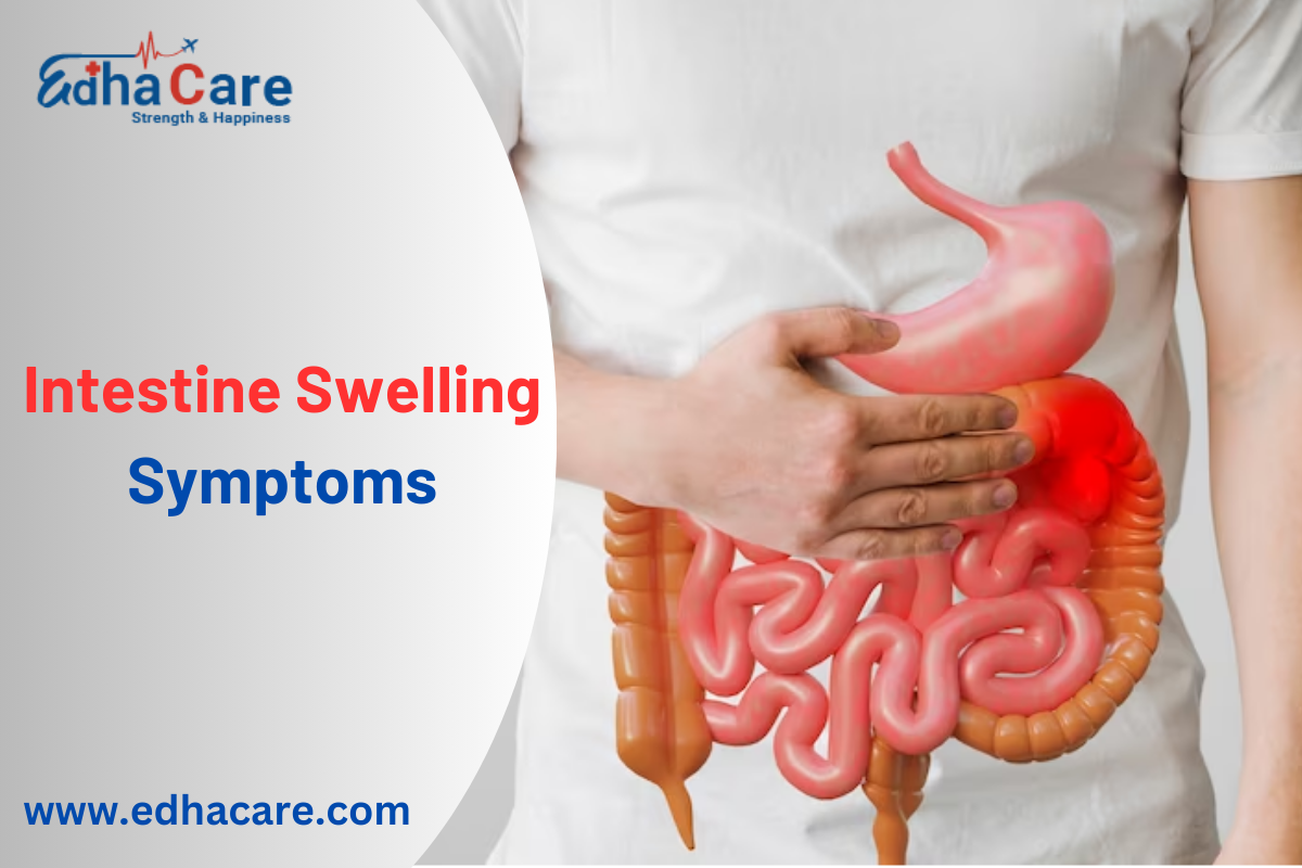 Symptômes de gonflement intestinal - EdhaCare