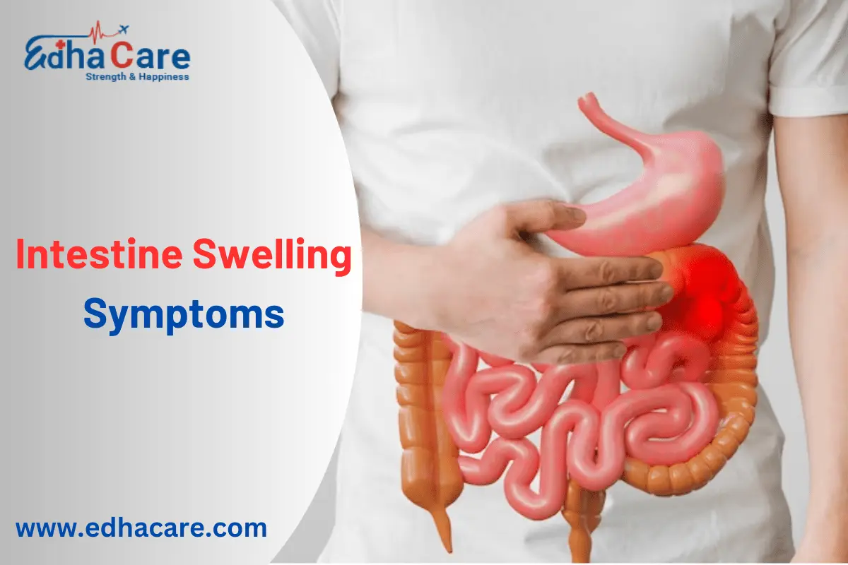 Intestine swelling symptoms