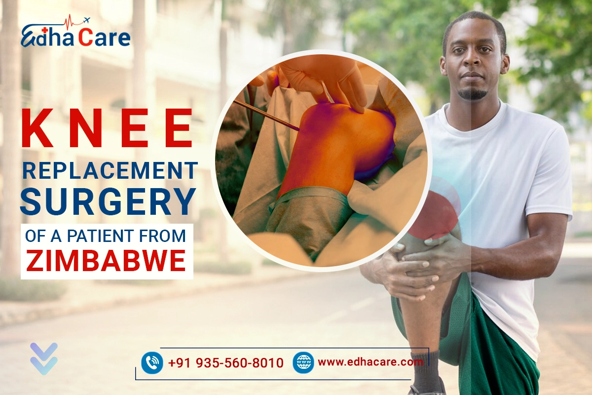 Successful Knee Replacement Surgery from Zimbabwe to India