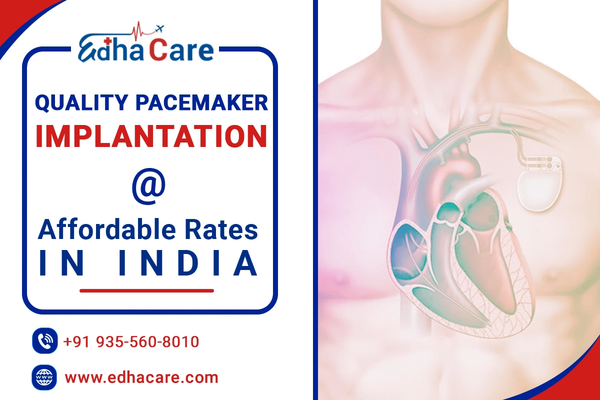 តម្លៃនៃការផ្សាំ Pacemaker នៅក្នុងប្រទេសឥណ្ឌា