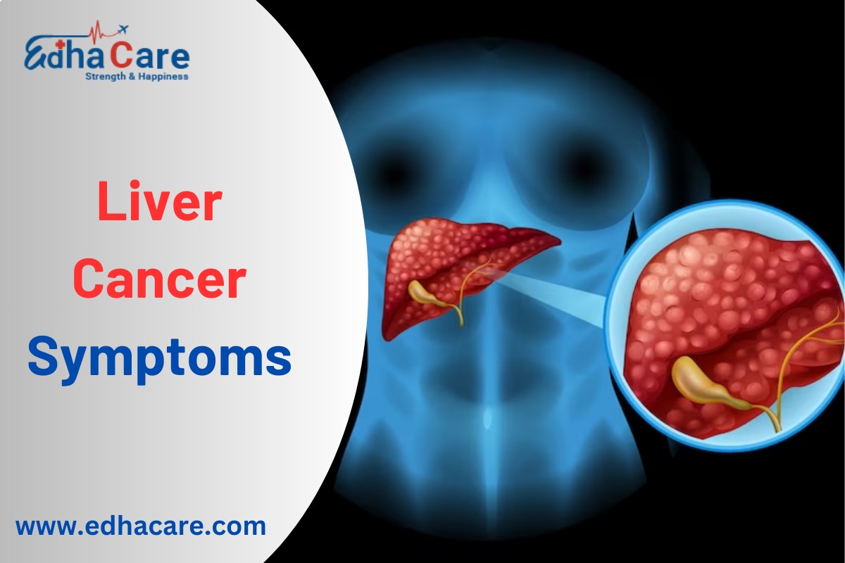 Liver Cancer Symptoms