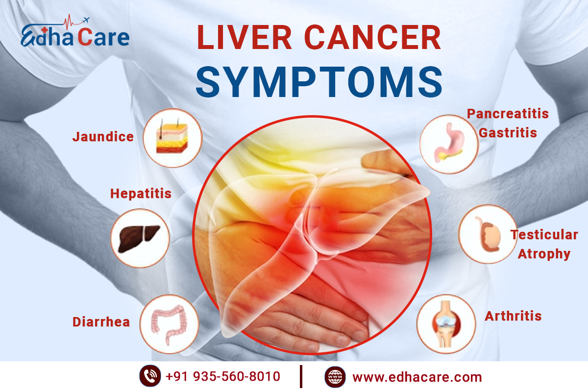 Liver Cancer Symptoms