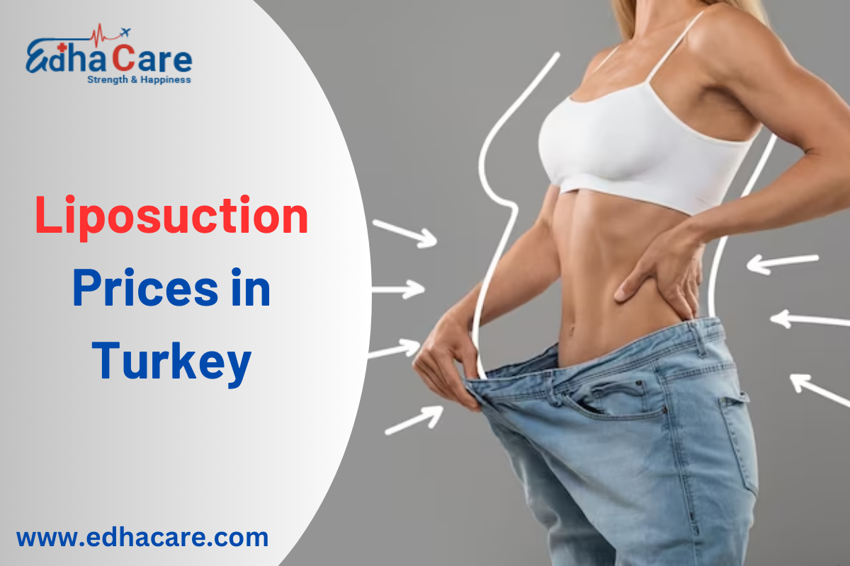 Liposuction Prices in Turkey
