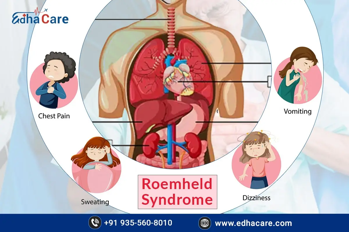 Tratamiento del síndrome de Roemheld