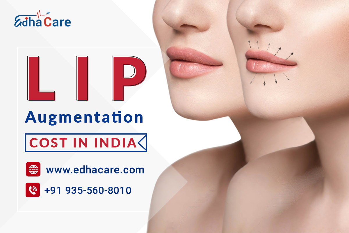 Lip Augmentation Cost In India EdhaCare