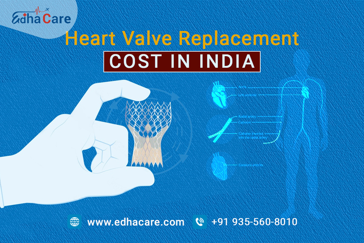 Heart Valve Replacement Cost In India
