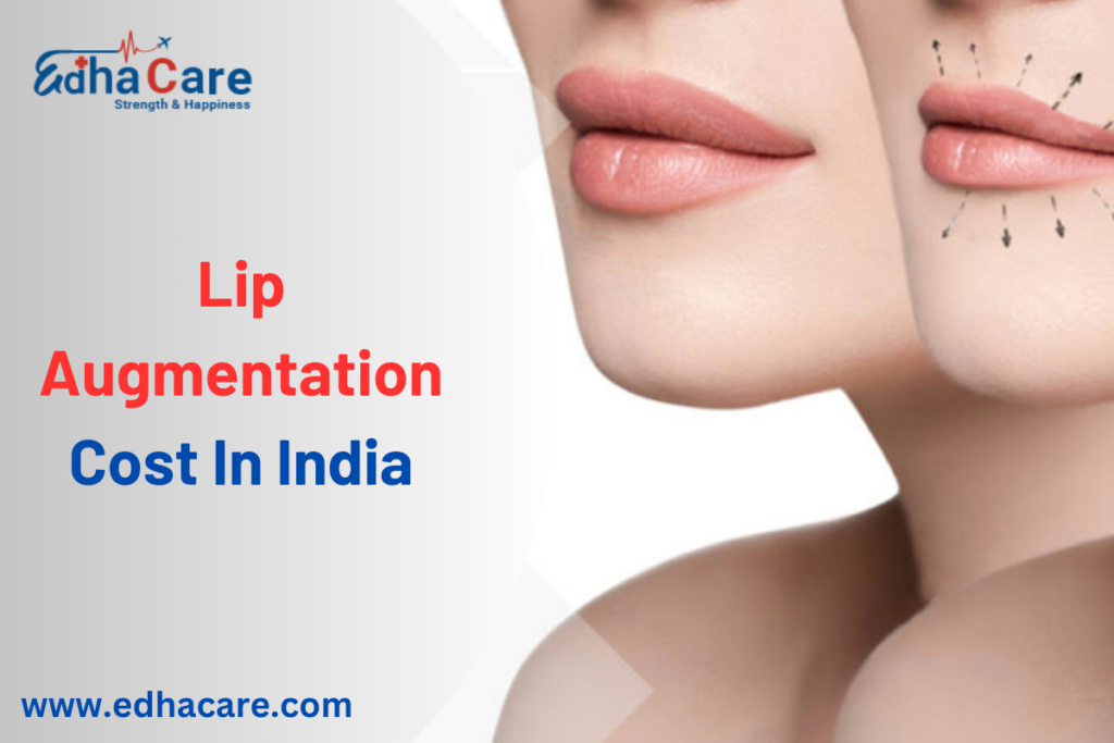 Lip Augmentation Cost In India EdhaCare