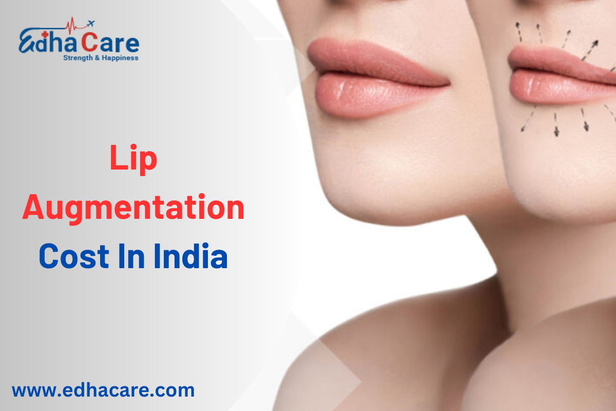 Costo de aumento de labios en la India