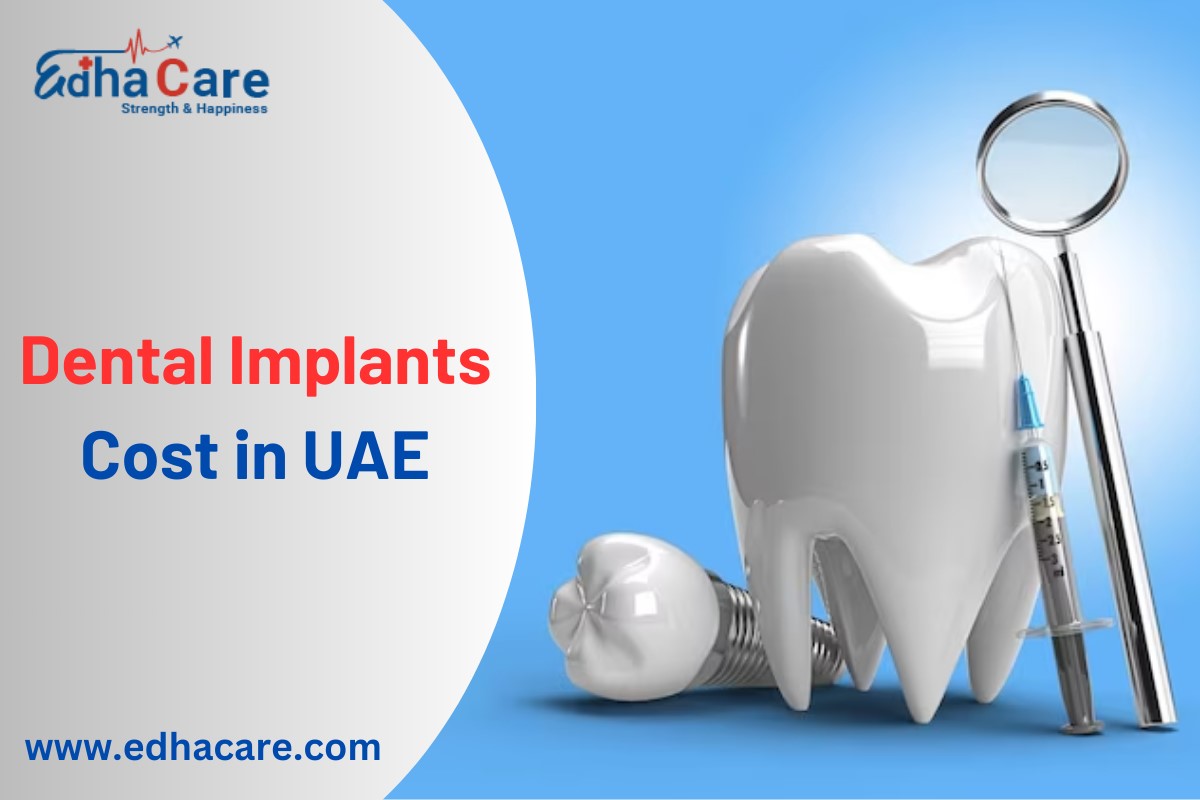 Dental implants cost in UAE