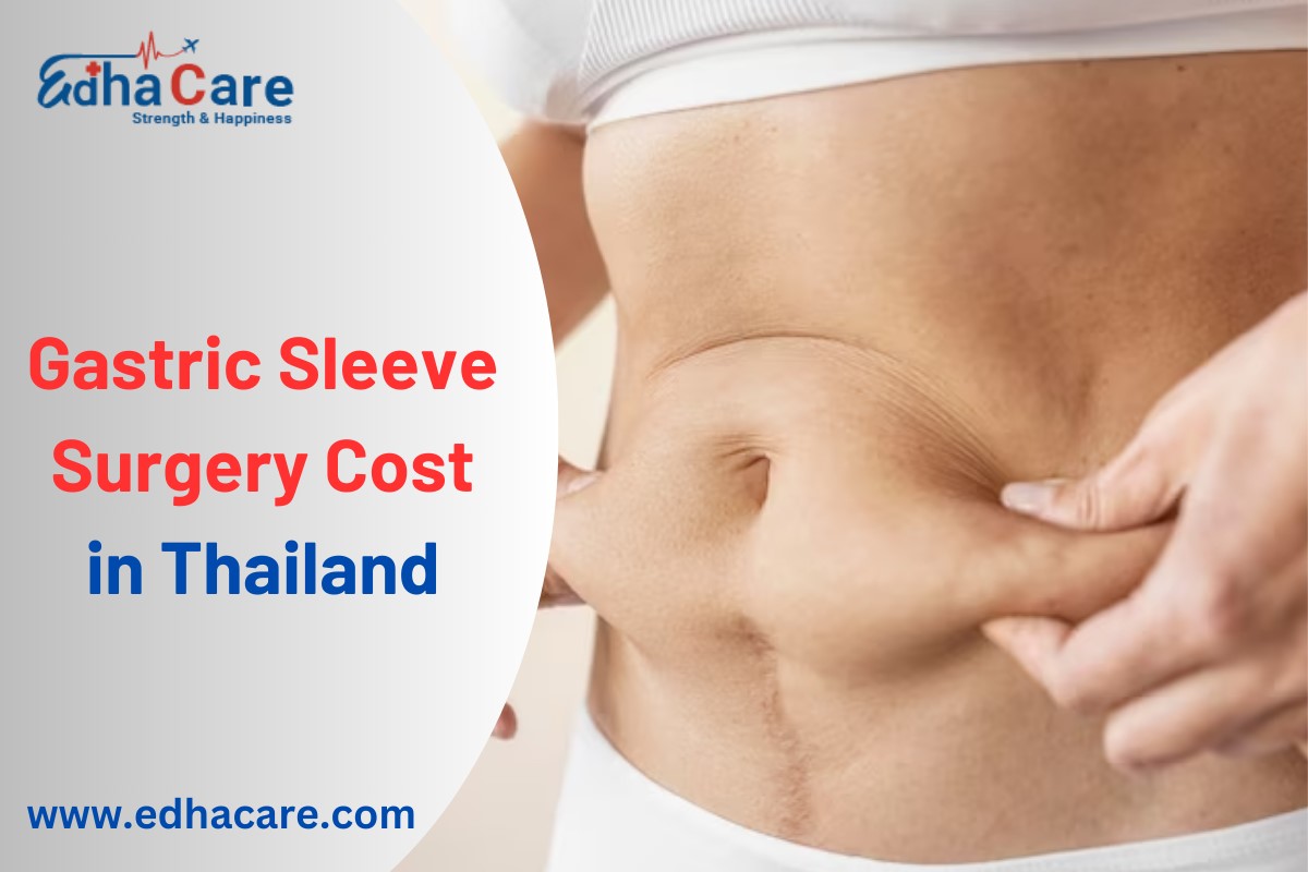 Gastric Sleeve Surgery Cost in Thailand – Estimated Pricing & Key Factors