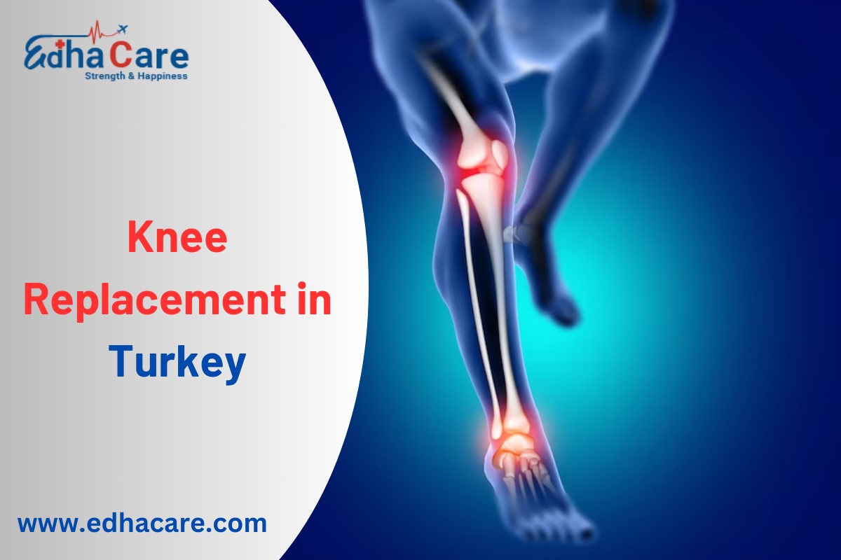Reemplazo de rodilla en Turquía