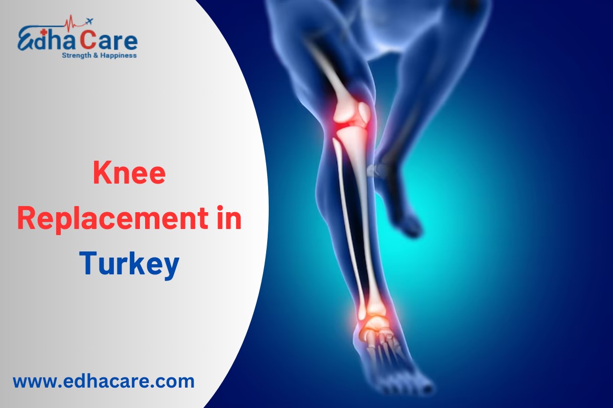 Substituição de joelho na Turquia