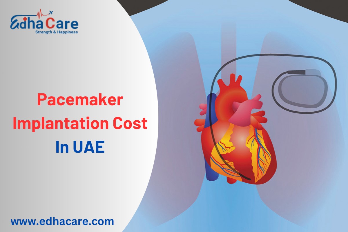 តម្លៃនៃការផ្សាំ Pacemaker នៅ UAE