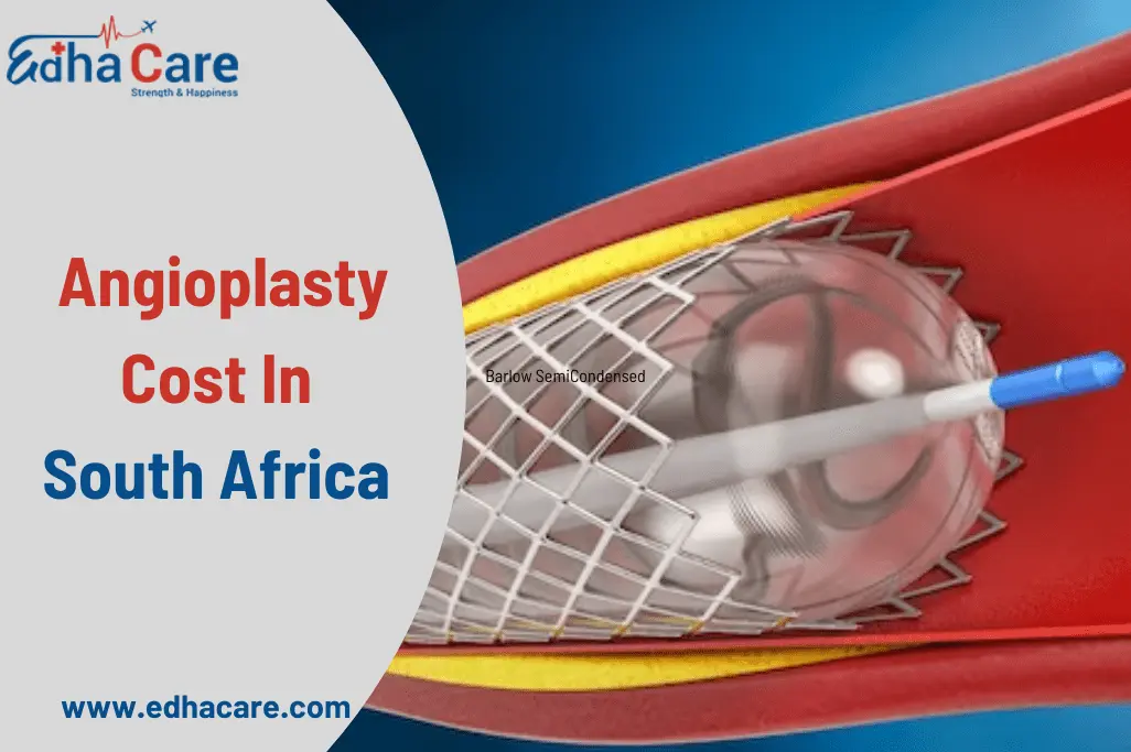 Angioplastiekkoste in Suid-Afrika