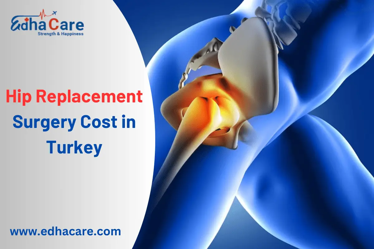 Coût de l'arthroplastie de la hanche en Turquie
